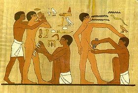 circuncisión